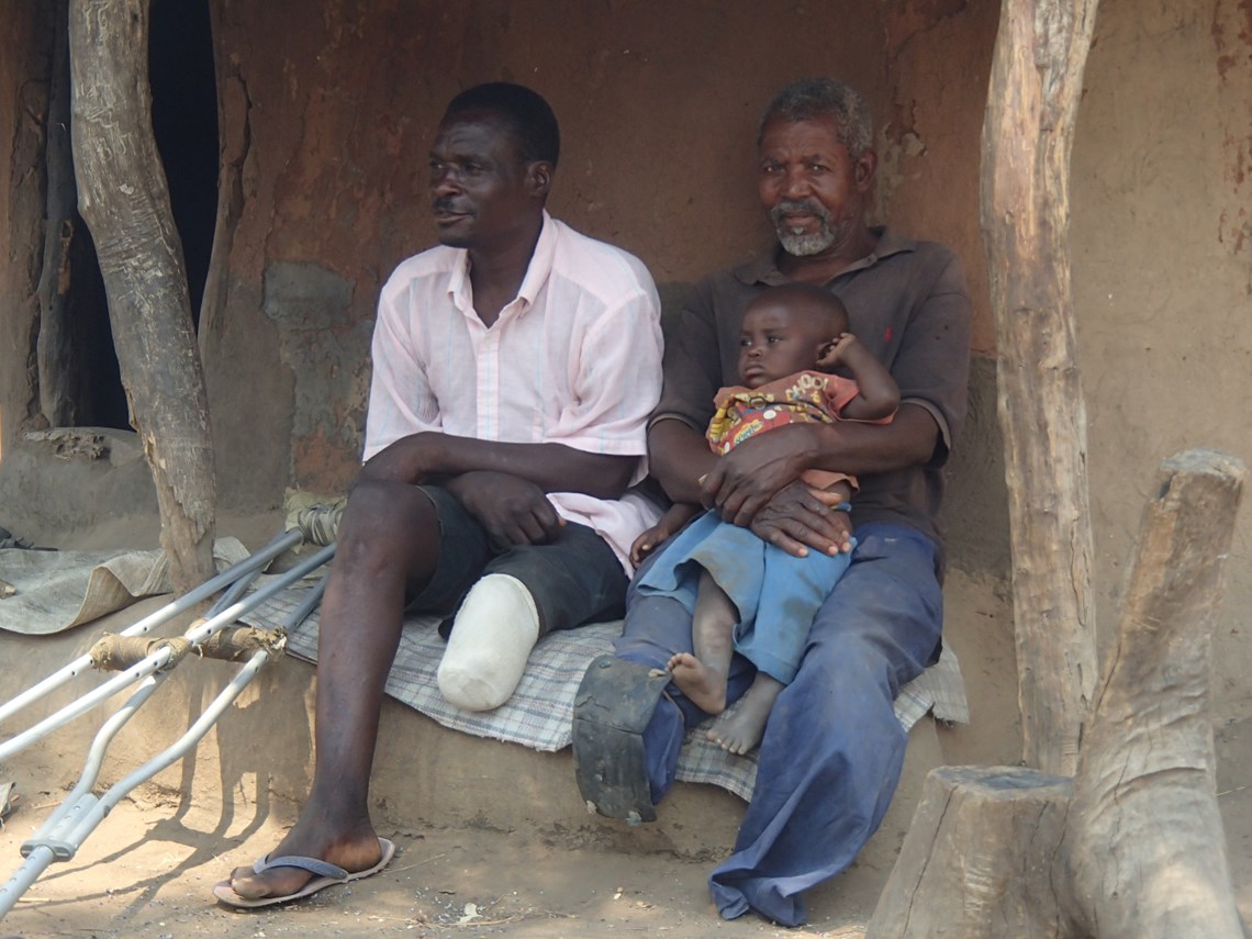 Landmine survivors, Zimbabwe, HALO Trust