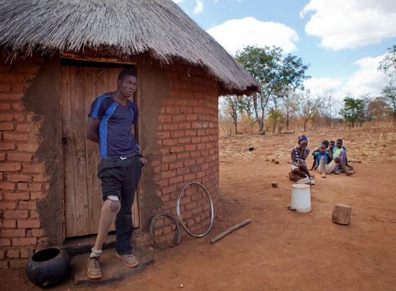 Landmine survivor, Zimbabwe, HALO Trust